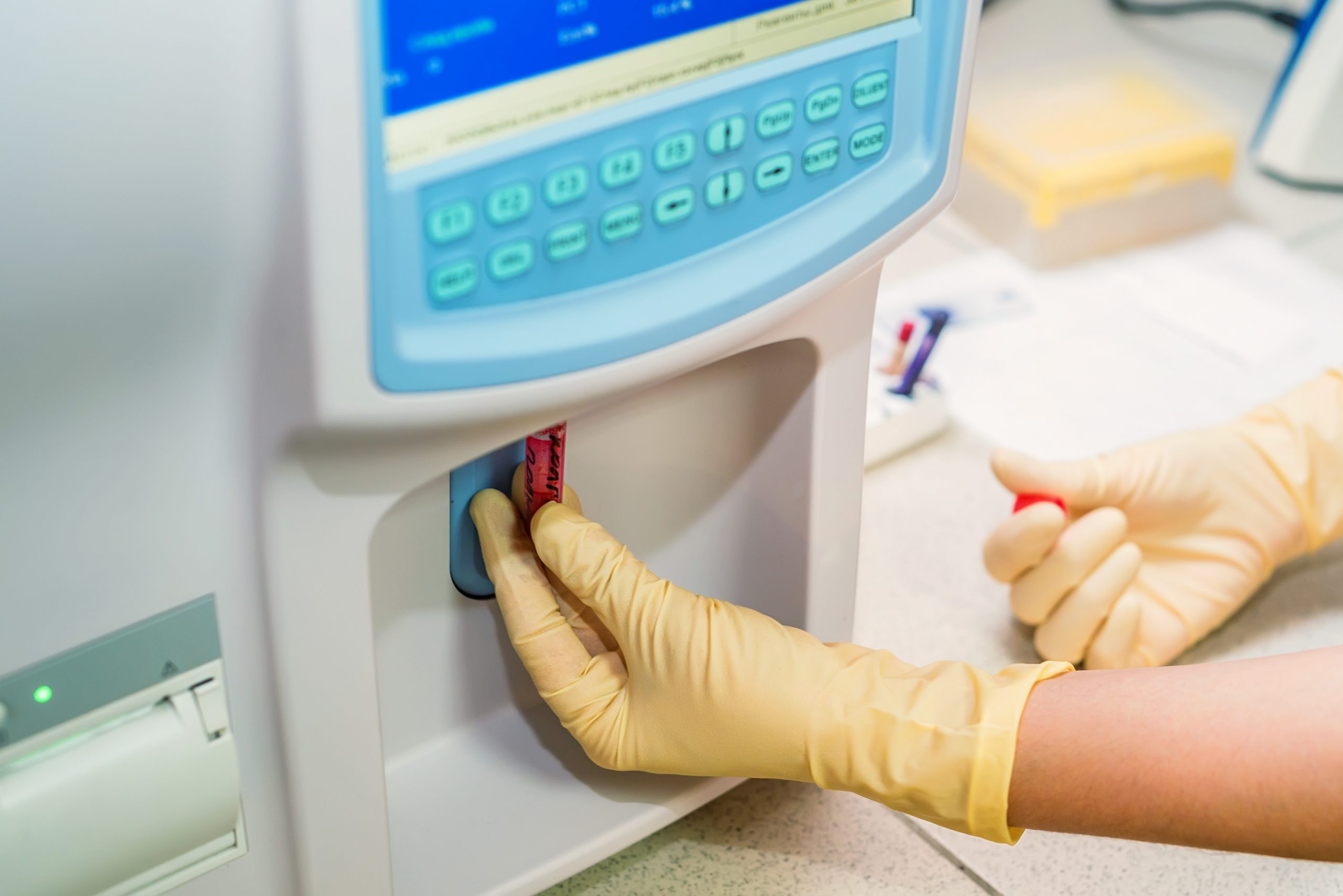 ¿Como funciona un analizador de química clínica?