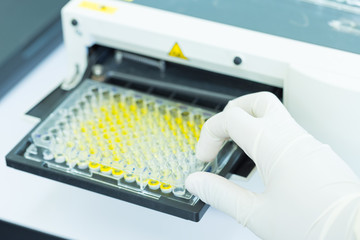 ¿Cómo es la Técnica de Elisa para detectar alérgenos en alimentos?