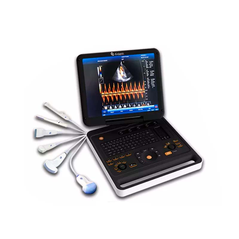 Descubre el Avance de la Tecnología Médica con el Sistema de Diagnóstico Ultrasónico Doppler Color