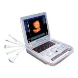 Innovación y Precisión en Diagnósticos Médicos: Escáner De Ultrasonido